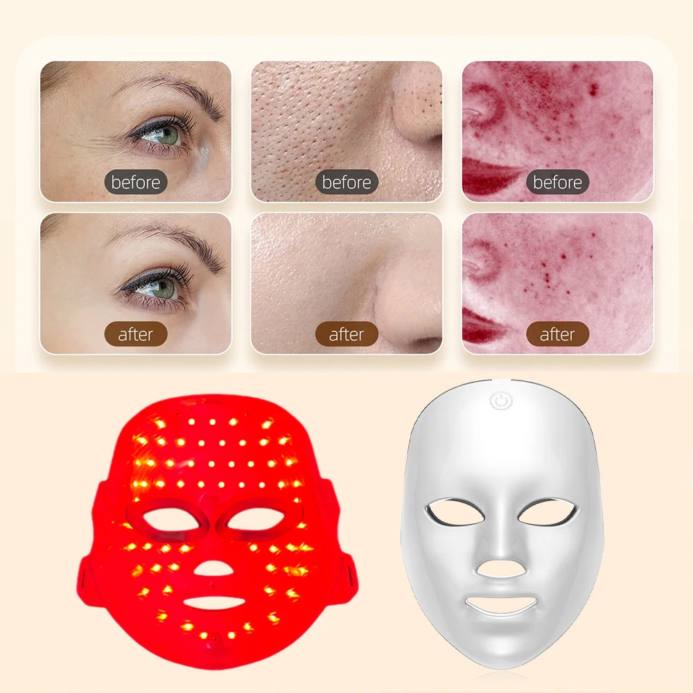 LumiGlow™ 7-Color LED Therapy Mask