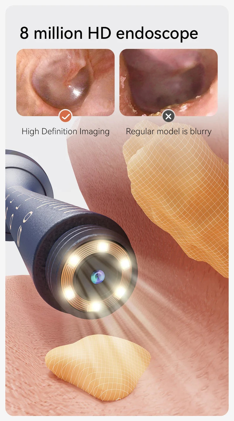ClearView™ Smart Ear Care Pro