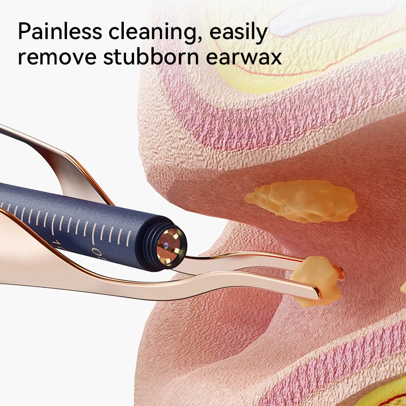 ClearView™ Smart Ear Care Pro