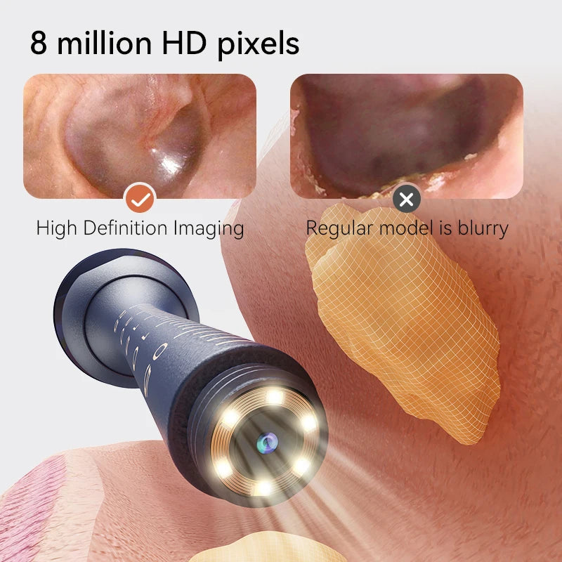 ClearView™ Smart Ear Care Pro