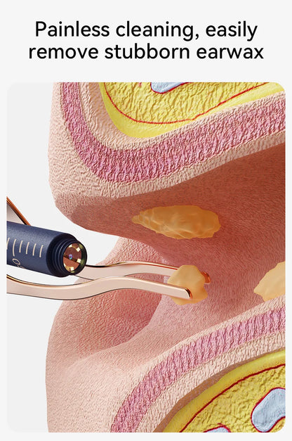 ClearView™ Smart Ear Care Pro